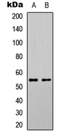 WB analysis of HEK293T (A), UV-treated A431 (B) whole cell lysates using GTX55032 SGK1 (phospho Ser78) antibody.
