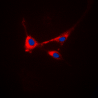 ICC/IF analysis of formalin-fixed HeLa cells using GTX55035 Stathmin 1 (phospho Ser25) antibody. Red : Primary antibody Blue : DAPI Permeabilization : 0.1% Triton X-100 in TBS for 5-10 minutes ICC/IF analysis of formalin-fixed HeLa cells using GTX55035 Stathmin 1 (phospho Ser25) antibody. Red : Primary antibody Blue : DAPI Permeabilization : 0.1% Triton X-100 in TBS for 5-10 minutes