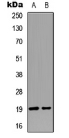 WB analysis of calyculin A-treated HeLa (A), Jurkat (B) whole cell lysates using GTX55035 Stathmin 1 (phospho Ser25) antibody.