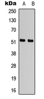 WB analysis of UV-treated HUVEC (A), UV-treated HEK293T (B) whole cell lysates using GTX55046 ATF2 (phospho Thr71) antibody.