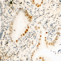 IHC-P analysis of formalin fixed human kidney tissue section using GTX55052 Cyclin H (phospho Thr315) antibody. Antigen retrieval : Heat mediated antigen retrieval with sodium citrate buffer (pH 6.0) IHC-P analysis of formalin fixed human kidney tissue section using GTX55052 Cyclin H (phospho Thr315) antibody. Antigen retrieval : Heat mediated antigen retrieval with sodium citrate buffer (pH 6.0)