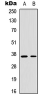 WB analysis of UV-treated Jurkat (A), UV-treated A549 (B) whole cell lysates using GTX55052 Cyclin H (phospho Thr315) antibody.