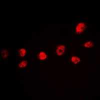 ICC/IF analysis of formalin-fixed HeLa cells using GTX55056 CREB (phospho Ser142) antibody. Red : Primary antibody Blue : DAPI Permeabilization : 0.1% Triton X-100 in TBS for 5-10 minutes ICC/IF analysis of formalin-fixed HeLa cells using GTX55056 CREB (phospho Ser142) antibody. Red : Primary antibody Blue : DAPI Permeabilization : 0.1% Triton X-100 in TBS for 5-10 minutes