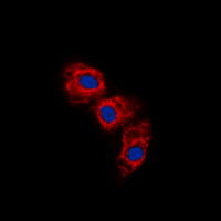 ICC/IF analysis of formalin-fixed COLO205 cells using GTX55065 GFAP (phospho Ser38) antibody. Red : Primary antibody Blue : DAPI Permeabilization : 0.1% Triton X-100 in TBS for 5-10 minutes ICC/IF analysis of formalin-fixed COLO205 cells using GTX55065 GFAP (phospho Ser38) antibody. Red : Primary antibody Blue : DAPI Permeabilization : 0.1% Triton X-100 in TBS for 5-10 minutes