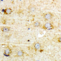 IHC-P analysis of formalin fixed human brain tissue section using GTX55065 GFAP (phospho Ser38) antibody. Antigen retrieval : Heat mediated antigen retrieval with sodium citrate buffer (pH 6.0)