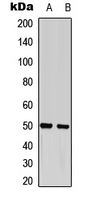 WB analysis of COLO205 (A), mouse brain (B) whole cell lysates using GTX55065 GFAP (phospho Ser38) antibody.