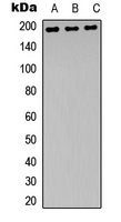 WB analysis of UV-treated HEK293T (A), mouse brain (B), rat brain (C) whole cell lysates using GTX55067 NMDAR2B (phospho Tyr1472) antibody. WB analysis of UV-treated HEK293T (A), mouse brain (B), rat brain (C) whole cell lysates using GTX55067 NMDAR2B (phospho Tyr1472) antibody.