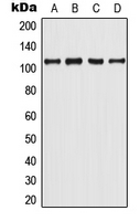 WB analysis of LNCaP (A), UV-treated MCF7 (B), mouse spleen (C), rat spleen (D) whole cell lysates using GTX55077 Androgen Receptor (phospho Tyr363) antibody. WB analysis of LNCaP (A), UV-treated MCF7 (B), mouse spleen (C), rat spleen (D) whole cell lysates using GTX55077 Androgen Receptor (phospho Tyr363) antibody.