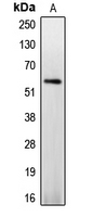 WB analysis of PMA-treated Jurkat (A) whole cell lysates using GTX55080 Caspase 8 (phospho Ser347) antibody.