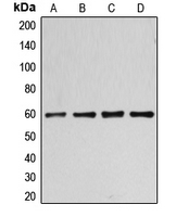 WB analysis of nocodazole-treated HT29 (A), Jurkat (B), HeLa (C), Raw264.7 (D) whole cell lysates using GTX55085 Cyclin B1 (phospho Ser126) antibody. WB analysis of nocodazole-treated HT29 (A), Jurkat (B), HeLa (C), Raw264.7 (D) whole cell lysates using GTX55085 Cyclin B1 (phospho Ser126) antibody.