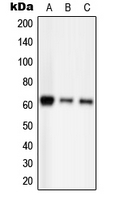 WB analysis of EGF-treated HEK293T (A), EGF-treated Raw264.7 (B), EGF-treated H9C2 (C) whole cell lysates using GTX55101 PAK2 (phospho Ser20) antibody. WB analysis of EGF-treated HEK293T (A), EGF-treated Raw264.7 (B), EGF-treated H9C2 (C) whole cell lysates using GTX55101 PAK2 (phospho Ser20) antibody.