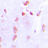 IHC-P analysis of formalin fixed human brain tissue section using GTX55105 Bcl-2 (phospho Thr69) antibody. Antigen retrieval : Heat mediated antigen retrieval with sodium citrate buffer (pH 6.0) IHC-P analysis of formalin fixed human brain tissue section using GTX55105 Bcl-2 (phospho Thr69) antibody. Antigen retrieval : Heat mediated antigen retrieval with sodium citrate buffer (pH 6.0)