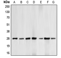 WB analysis of UV-treated HepG2 (A), HeLa (B), HL60 (C), THP1 (D), paclitaxel-treated Jurkat (E), H2O2-treated NIH3T3(F), H2O2-treated PC12(G) whole cell lysates using GTX55105 Bcl-2 (phospho Thr69) antibody.