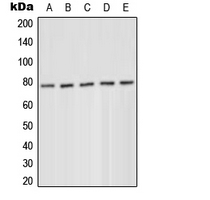 WB analysis of serum starvation-treated MCF7 (A), PMA-treated HeLa (B), Jurkat (C), serum starvation-treated Raw264.7 (D), serum starvation-treated H9C2 (E) whole cell lysates using GTX55112 PKC delta (phospho Tyr52) antibody. WB analysis of serum starvation-treated MCF7 (A), PMA-treated HeLa (B), Jurkat (C), serum starvation-treated Raw264.7 (D), serum starvation-treated H9C2 (E) whole cell lysates using GTX55112 PKC delta (phospho Tyr52) antibody.