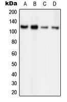 WB analysis of HeLa (A), MCF7 (B), PC12 (C), Ramos (D) whole cell lysates using GTX55162 ORC1 antibody. WB analysis of HeLa (A), MCF7 (B), PC12 (C), Ramos (D) whole cell lysates using GTX55162 ORC1 antibody.