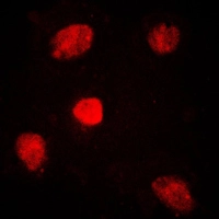 ICC/IF analysis of formalin-fixed HUVEC cells using GTX55164 MED1 antibody. Red : Primary antibody Blue : DAPI Permeabilization : 0.1% Triton X-100 in TBS for 5-10 minutes ICC/IF analysis of formalin-fixed HUVEC cells using GTX55164 MED1 antibody. Red : Primary antibody Blue : DAPI Permeabilization : 0.1% Triton X-100 in TBS for 5-10 minutes