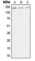 WB analysis of HeLa (A), HUVEC (B), Jurkat (C) whole cell lysates using GTX55164 MED1 antibody.