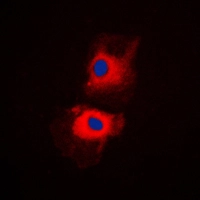 ICC/IF analysis of formalin-fixed K562 cells using GTX55170 RPL27A antibody. Red : Primary antibody Blue : DAPI Permeabilization : 0.1% Triton X-100 in TBS for 5-10 minutes ICC/IF analysis of formalin-fixed K562 cells using GTX55170 RPL27A antibody. Red : Primary antibody Blue : DAPI Permeabilization : 0.1% Triton X-100 in TBS for 5-10 minutes