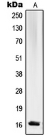WB analysis of K562 (A) whole cell lysates using GTX55170 RPL27A antibody.