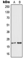 WB analysis of HEK293T (A), MCF7 (B) whole cell lysates using GTX55171 Secretogranin V antibody. WB analysis of HEK293T (A), MCF7 (B) whole cell lysates using GTX55171 Secretogranin V antibody.