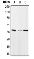 WB analysis of HeLa (A), Raw264.7 (B), PC12 (C) whole cell lysates using GTX55178 MTERF antibody. WB analysis of HeLa (A), Raw264.7 (B), PC12 (C) whole cell lysates using GTX55178 MTERF antibody.