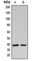 WB analysis of Jurkat (A), HUVEC (B) whole cell lysates using GTX55180 B3GALT1 antibody. WB analysis of Jurkat (A), HUVEC (B) whole cell lysates using GTX55180 B3GALT1 antibody.