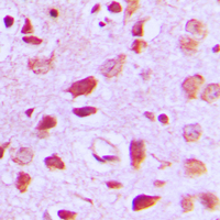 IHC-P analysis of formalin fixed human brain tissue section using GTX55185 EIF5B antibody. Antigen retrieval : Heat mediated antigen retrieval with sodium citrate buffer (pH 6.0) IHC-P analysis of formalin fixed human brain tissue section using GTX55185 EIF5B antibody. Antigen retrieval : Heat mediated antigen retrieval with sodium citrate buffer (pH 6.0)