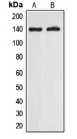 WB analysis of A549 (A), Jurkat (B) whole cell lysates using GTX55185 EIF5B antibody.