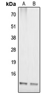 WB analysis of IMR32 (A), HepG2 (B) whole cell lysates using GTX55188 COX17 antibody.