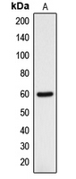 WB analysis of HOS (A) whole cell lysates using GTX55207 DCLRE1B antibody.