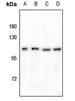 WB analysis of various lysates using GTX55215 GPR110 antibody. Dilution : 1:500 (A) HEK293T (B) PC12 (C) CT26 (D) Hela WB analysis of various lysates using GTX55215 GPR110 antibody. Dilution : 1:500 (A) HEK293T (B) PC12 (C) CT26 (D) Hela