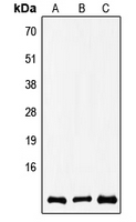 WB analysis of A549 (A), SP2/0 (B), rat brain (C) whole cell lysates using GTX55216 COX8A antibody. WB analysis of A549 (A), SP2/0 (B), rat brain (C) whole cell lysates using GTX55216 COX8A antibody.