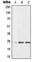 WB analysis of MCF7 (A), SP2/0 (B), PC12 (C) whole cell lysates using GTX55217 IPP1 antibody. WB analysis of MCF7 (A), SP2/0 (B), PC12 (C) whole cell lysates using GTX55217 IPP1 antibody.