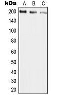 WB analysis of HepG2 (A), mouse liver (B), rat liver (C) whole cell lysates using GTX55219 UBR2 antibody. WB analysis of HepG2 (A), mouse liver (B), rat liver (C) whole cell lysates using GTX55219 UBR2 antibody.
