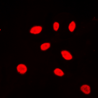 ICC/IF analysis of formalin-fixed Jurkat cells using GTX55226 ZNF174 antibody. Red : Primary antibody Blue : DAPI Permeabilization : 0.1% Triton X-100 in TBS for 5-10 minutes ICC/IF analysis of formalin-fixed Jurkat cells using GTX55226 ZNF174 antibody. Red : Primary antibody Blue : DAPI Permeabilization : 0.1% Triton X-100 in TBS for 5-10 minutes