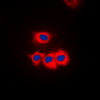 ICC/IF analysis of formalin-fixed Jurkat cells using GTX55230 Casein Kinase 1 gamma antibody. Red : Primary antibody Blue : DAPI Permeabilization : 0.1% Triton X-100 in TBS for 5-10 minutes ICC/IF analysis of formalin-fixed Jurkat cells using GTX55230 Casein Kinase 1 gamma antibody. Red : Primary antibody Blue : DAPI Permeabilization : 0.1% Triton X-100 in TBS for 5-10 minutes