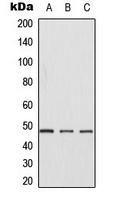 WB analysis of Jurkat (A), NIH3T3 (B), H9C2 (C) whole cell lysates using GTX55230 Casein Kinase 1 gamma antibody.