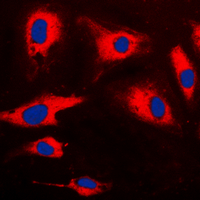 ICC/IF analysis of formalin-fixed HeLa cells using GTX55231 CARD14 antibody. Red : Primary antibody Blue : DAPI Permeabilization : 0.1% Triton X-100 in TBS for 5-10 minutes ICC/IF analysis of formalin-fixed HeLa cells using GTX55231 CARD14 antibody. Red : Primary antibody Blue : DAPI Permeabilization : 0.1% Triton X-100 in TBS for 5-10 minutes