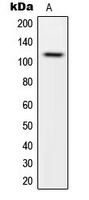 WB analysis of HeLa (A) whole cell lysates using GTX55231 CARD14 antibody.