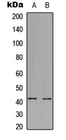 WB analysis of A549 (A), H9C2 (B) whole cell lysates using GTX55244 GPR85 antibody. WB analysis of A549 (A), H9C2 (B) whole cell lysates using GTX55244 GPR85 antibody.