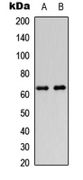 WB analysis of HeLa (A), HEK293T (B) whole cell lysates using GTX55262 DGKE antibody. WB analysis of HeLa (A), HEK293T (B) whole cell lysates using GTX55262 DGKE antibody.