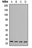 WB analysis of MCF7 (A), HepG2 (B), Raw264.7 (C), H9C2 (D) whole cell lysates using GTX55265 FGF6 antibody. WB analysis of MCF7 (A), HepG2 (B), Raw264.7 (C), H9C2 (D) whole cell lysates using GTX55265 FGF6 antibody.