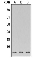 WB analysis of MCF7 (A), NS-1 (B), PC12 (C) whole cell lysates using GTX55271 XTP4 antibody. WB analysis of MCF7 (A), NS-1 (B), PC12 (C) whole cell lysates using GTX55271 XTP4 antibody.