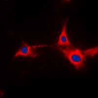 ICC/IF analysis of formalin-fixed HepG2 cells using GTX55273 PFKFB2 antibody. Red : Primary antibody Blue : DAPI Permeabilization : 0.1% Triton X-100 in TBS for 5-10 minutes