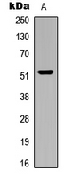 WB analysis of human brain (A) whole cell lysates using GTX55280 CARKL antibody.