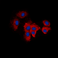 ICC/IF analysis of formalin-fixed A549 cells using GTX55288 KDELR2 antibody. Red : Primary antibody Blue : DAPI Permeabilization : 0.1% Triton X-100 in TBS for 5-10 minutes ICC/IF analysis of formalin-fixed A549 cells using GTX55288 KDELR2 antibody. Red : Primary antibody Blue : DAPI Permeabilization : 0.1% Triton X-100 in TBS for 5-10 minutes