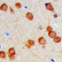 IHC-P analysis of formalin fixed human brain tissue section using GTX55288 KDELR2 antibody. Antigen retrieval : Heat mediated antigen retrieval with sodium citrate buffer (pH 6.0)