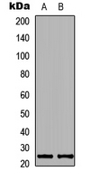 WB analysis of SH-SY5Y (A), NIH3T3 (B) whole cell lysates using GTX55288 KDELR2 antibody.