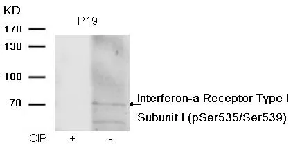 WB analysis of extracts from P19 cells treated with calf intestinal phosphatase (CIP) using GTX55295 IFNAR1 (phospho Ser535/Ser539) antibody. WB analysis of extracts from P19 cells treated with calf intestinal phosphatase (CIP) using GTX55295 IFNAR1 (phospho Ser535/Ser539) antibody.