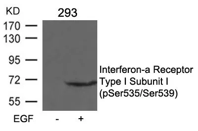 WB analysis of extracts from 293 cells untreated or treated with EGF using GTX55295 IFNAR1 (phospho Ser535/Ser539) antibody.